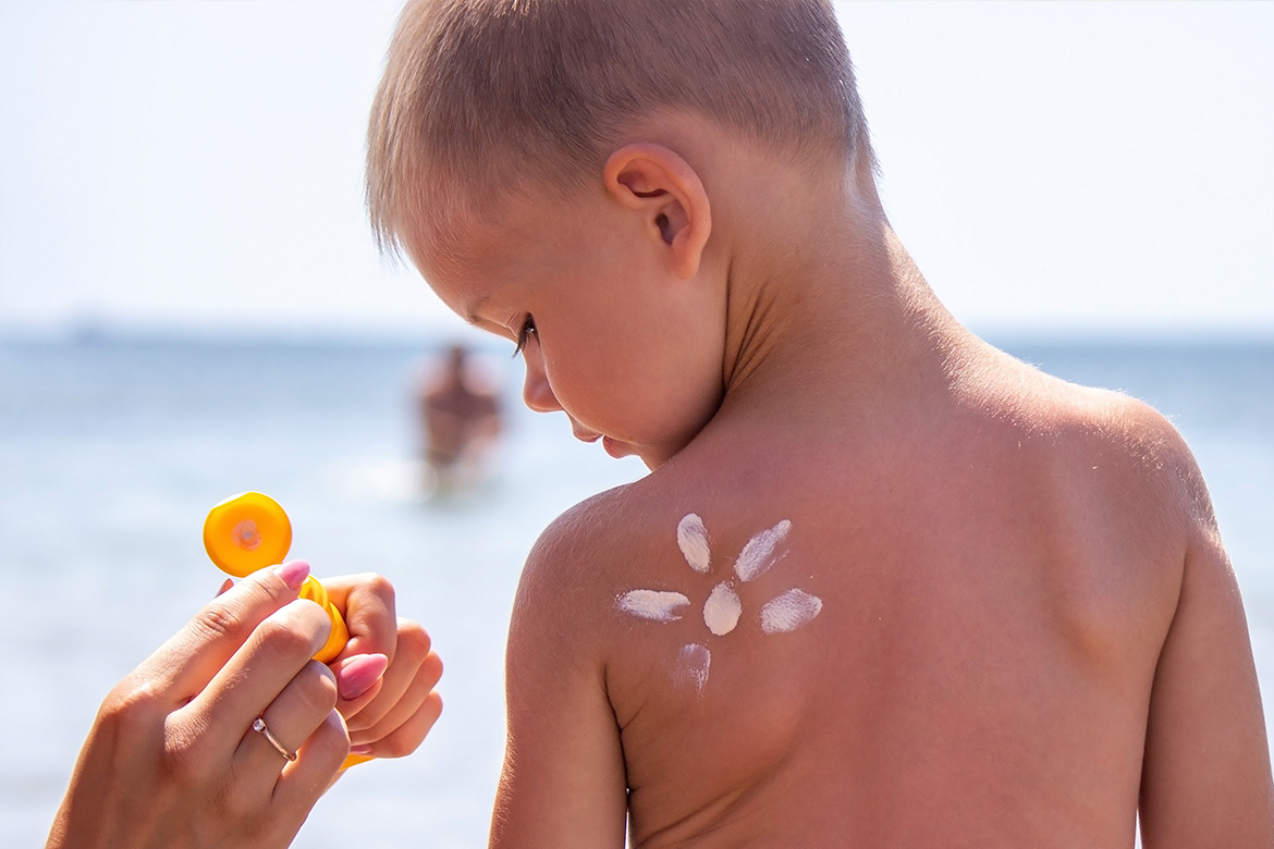 Properly Caring For Children’s Sunburn - 